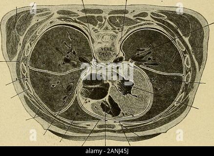 Courbure latérale de la colonne vertébrale et des épaules . Fig. 6.-Modèle de la colonne vertébrale montrant les relations, en particulier l'theAnatomical Dis-position des parties molles dans la LumbarRegion.- {Warren Museum.) 14 ANATOMIE DE LA COLONNE VERTÉBRALE ET DU THORAX ou asternal fausses côtes ; le huitième, neuvième et dixième s'distinguishedas vertebrochondral, tels qu'ils sont indirectement antérieurement par le thesternum united de cartilage de la côte ou des côtes au-dessus ; le onzième andtwelfth jQoating sont appelés les côtes, que leurs extrémités sont loosein antérieure de la paroi abdominale. L'augmentation de la longueur des côtes du firstto le septième ou Banque D'Images