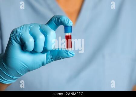 Technicien médical contient de petits échantillons de sang en tube main gantée. Banque D'Images