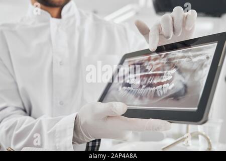 Gros plan d'une tablette électronique avec des images radiographiques des dents du client qui maintiennent un médecin mâle dans des gants en caoutchouc blanc. Dentiste professionnel utilisant des technologies modernes dans le traitement oral. Banque D'Images