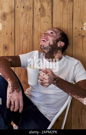 Jeune homme avec vitiligo ayant une tasse de café et riant dans une cafétéria Banque D'Images