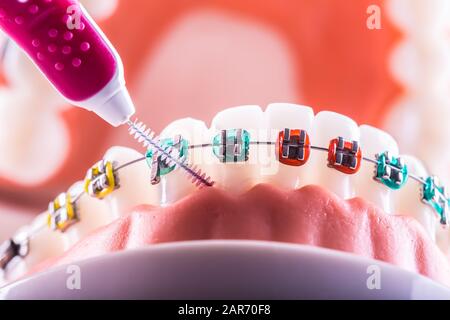Modèle de dent à partir d'étrésillons dentaires avec brosse de nettoyage pour dents interdentaires Banque D'Images