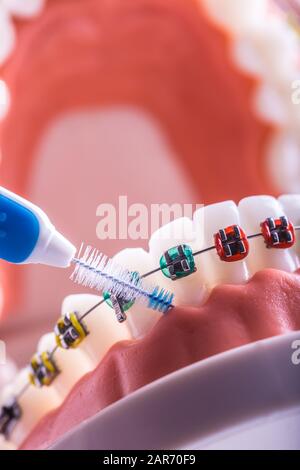 Modèle de dent à partir d'étrésillons dentaires avec brosse de nettoyage pour dents interdentaires Banque D'Images