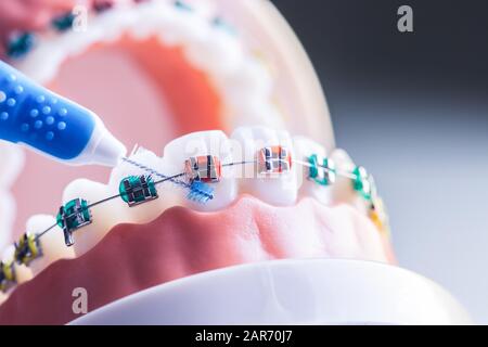 Modèle de dent à partir d'étrésillons dentaires avec brosse de nettoyage pour dents interdentaires Banque D'Images