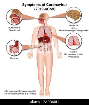 Coronavirus médico vectoriel infographie, symptômes Illustration de Vecteur