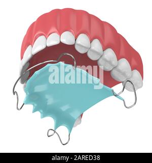 rendu tridimensionnel de la mâchoire avec dispositif de retenue orthodontique amovible sur fond blanc Banque D'Images