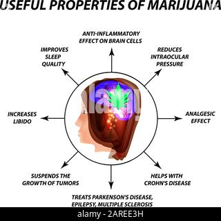 Propriétés utiles du cannabis. Traitement du cannabis. Cannabinoïde, chanvre. Feuille de marijuana et cerveau humain. Infographies. Illustration vectorielle sur isolée Illustration de Vecteur