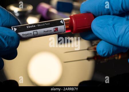 Test sanguin du virus Ebola positif pour les symptômes d'infections. Prévenir les patients atteints de crise sanitaire d'Ebola pour confirmer la maladie. CDC empêchant le Banque D'Images