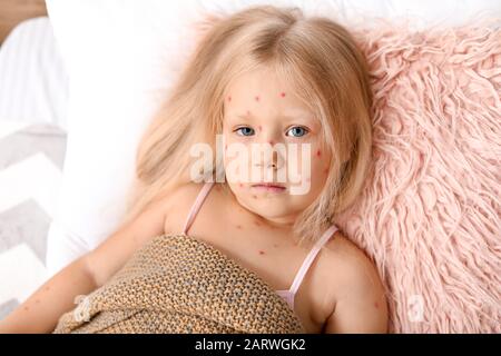 Petite fille malade avec la varicelle posée dans le lit Banque D'Images