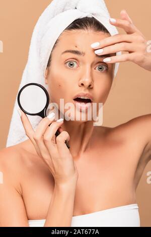 jeune femme surprise avec des boutons sur le visage tenant loupe isolée sur beige Banque D'Images