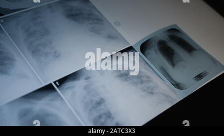 Concept de radiographie pulmonaire. Médecin en radiologie examinant sur la poitrine du film radiographique du patient dans la salle d'hôpital. Concept Médical. Banque D'Images