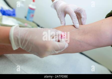 Le médecin injecte une aiguille de perfusion dans un patient Banque D'Images
