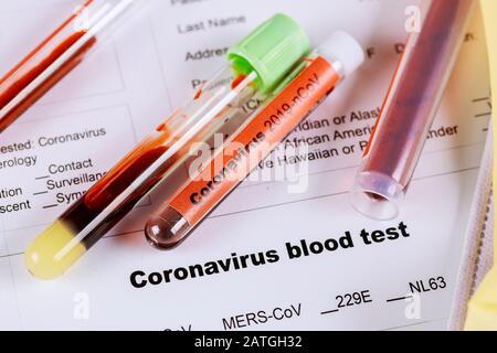 Coronavirus du syndrome respiratoire du Moyen-Orient du MERS-CoV avec échantillon sanguin Banque D'Images