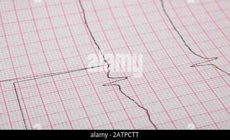 Alignement du cardiogramme, maladies cardiaques, macro photo Banque D'Images