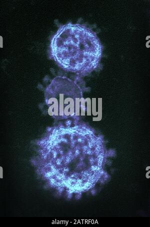 Image microscopique d'électrons de transmission fortement agrandie et colorisée numériquement (TEM) montrant des détails ultrastructuraux exposés par trois virons de coronavirus (MERS-CoV) de syndrome respiratoire du Moyen-Orient, en forme sphérique, 2014. Le MERS appartient à la même famille que le nouveau coronavirus qui a commencé à infecter les patients à Wuhan, en Chine, au début de 2020. Avec la permission de l'Institut national des allergies et des maladies infectieuses (NIAID)/CDC. Image produite en 2014. () Banque D'Images