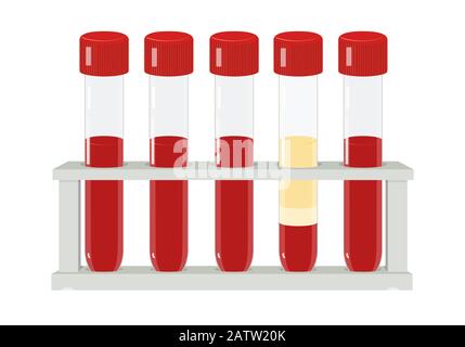 Cinq tubes à essai dans le portoir, illustration de vecteur médical Illustration de Vecteur