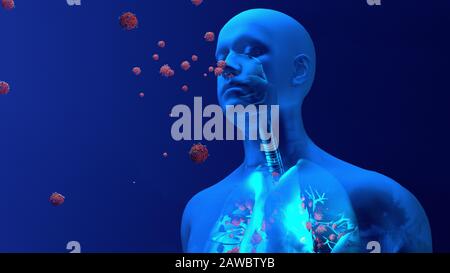 Infection pulmonaire du coronavirus, illustration conceptuelle Banque D'Images