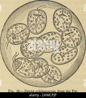 Un traité sur la pratique de la médecine, pour l'utilisation des étudiants et des praticiens . Fig. 12. Scolex isolé du Taenia ediinoceus, du Pig. Banque D'Images