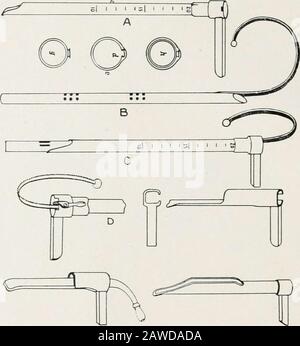 Endoscopie perorale et chirurgie laryngée . Fig. 2 et 3. Brunings deux poignées éclairantes pour laryngoscopes, bron-chooscopes et oesophagoscopes. Ingals utilise une forme améliorée de son bronchoscope d'éclairement distal original (Fig. J), avec lequel il a fait un travail remarquable de mise en œuvre. .Mosher utilise des ésojiiagoscopes de très grand diamètre transversal avec illumination distale. (Fig. .5.) ICfiorts à j)roducc oesophagoscopes et gastro-oscilloscopes jointés et angulaires continuent, et tout cela devrait être encouragé (à condition que de grands soins soient exercés) parce que tous les efforts ont pour résultat une attention accrue à toi Banque D'Images