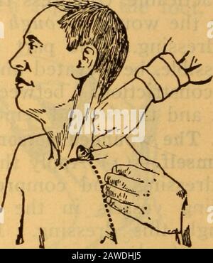 Les instructions de la force d'atterrissage et du petit bras, marine des États-Unis, 1905 . Plaque 19. Article 81.Compression de l'artère sous-clavière avec le pouce. Plaque 20. Article 81.Compression de l'ar-tère sous-clavien avec le guidon rembourré d'une clé de porte. Banque D'Images