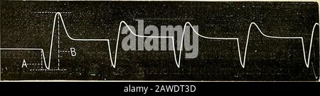 Le guide électro-thérapeutique, ou un millier de questions posées et répondues . Fig. I. traçage fait par le courant des appareils sinusoïdiens.. Fig. 2. C^irloyer de l'appareil faradique. A, marque ; B, pause. Banque D'Images