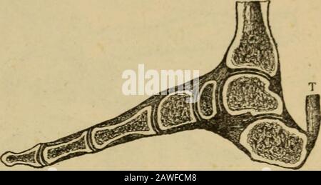 L'essentiel de la santé un livre de texte sur l'anatomie, la physiologie, l'hygiène, l'alcool et les stupéfiants . Fig. 62.. Le fémur. LE SQUELETTE. 17:;. Fig. 63. Vue latérale des os du pied, naturellement disposés dans le cadre d'une voûte plantaire. Côté de la jambe. La rotule, ou la table de genou, protège le genou devant. Os Du Pied. Les os du pied sont si unitedqu'ils forment une arche, dont seulement le devant et le dos touchent le sol. Cette arche est utile pour protéger le corps contre les chocs violents, comme dans l'action de courir ou de sauter; car c'est evi-dent que lorsque le poids du corps est jeté sur la voûte plantaire, Banque D'Images