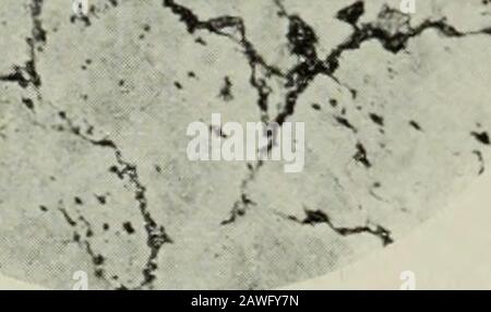 Rapport annuel . Une partie mince de la veine de quartz aurifère sur les rabes Wright-Hargreaves, le carbonate, la molyb-denite, le chlorite, le telluride (altaite?), l'or et d'autres minéraux se produisent dans les plans de fracture du quartz. (X 19 diamètres). Wright=Hargreaves la mine Wright-Hargreaves est située sur la fracturénear principale qui porte le minerai, au centre de la zone productive, où les roches porphyres ont la largeur de grandeur exposée dans la région. La zone minéralisée a été tracée par intermittence pendant 2 400 pieds sur la surface, et elle s'étend sans aucun doute sur 1 500 pieds à travers la partie de la propriété de la tewerstern, qui est couvert Banque D'Images