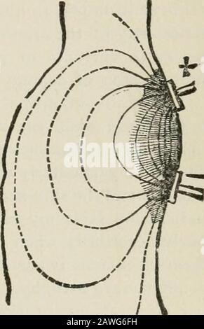 Conférences sur les maladies nerveuses du point de vue de la localisation cérébrale et spinale, et les méthodes ultérieures employées dans le diagnostic et le traitement de ces affections . - aussi modifier- certaines des morbides de la moelle épinière par électrification des extrémités lorsque le mât indifférent est placé sur des processus spinaux. Il est bon d'augmenter proportionnellement la taille des électrodes à la force du courant utilisé. Fig. 191 illustre l'effet de la séparation des pôles lorsque des applications de l'électricité sont faites à la colonne vertébrale. Certains des tliethreads de courant décrits sont re Banque D'Images