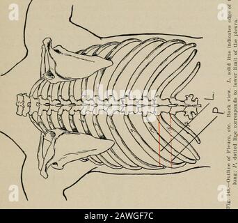 Chirurgie opératoire, pour les étudiants et les praticiens . il a quitté la frontière du thésternum, correspondant au cinquième cartilage costal, cinquième intercostaspace, et sixième cartilage costal, Ce qui n'est pas couvert par la plèvre.Si cette condition était présente, on pourrait introduire une aiguille aspiratingneedle dans le sac péricardique par le cinquième espace intercostal, près de la bordure gauche du sternum, sans rencontrer la thépleura. Sans doute, le bord antérieur du sac pleural gauche est sous-sujet à une variation considérable. J'ai trouvé la première description pour la plupart des cas. Le bord inférieur du pli Banque D'Images