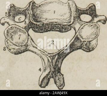 Un système d'anatomie humaine, général et spécial . e aux vaisseaux nutritifs. Sur sa surface postérieure se trouve une ouverture irrégulière unique, ou plusieurs, pour la sortie des vertèbres de venas. La lamina, commence sur les côtés de la partie postérieure du corps de la vertèbre par deux pédicules; ils se dilatent, et, arcingbacking, entourent un foramen qui sert à la protection du cordon thespinal. Les bords supérieur et inférieur des laminas sont plus rugueux pour l'attachement de la ligaenta subflava. Les concavités épiques et sous les pédicules sont les encoches intervertébrales. Le spinousprocess est bac Banque D'Images