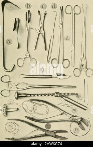 Chirurgie opératoire . cautérisation alvanique, ecrateur ou ligature. La dernière méthode et la dernière méthode de cautérisation thégalvanique devraient être exclues, car la plus grande longueur de timéraquired et la plus grande douleur causée par cette dernière, et les plus dangereux de l'hémorragie et de la sepsis de la première, ne les ajuster à l'usage. Si la partie malade est petite, elle peut être prise loin par l'incision mieux calculatedpour accomplir l'objet, car il est un mauvais plan pour assurer la symétrie à l'ex-pense de la sécurité future. Si l'hypertrophie implique le npex, ou si une tumeur héliosée à cette situation, l'une ou l'autre condition peut être traitée par rem Banque D'Images