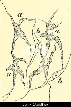 Éléments de l'anatomie de Quain . forme la couche externe de la rétine de l'œil et couvre la surface postérieure de l'iris. Le pigment sombre est également rencontré dans la Fig. 78. Fig. 78.^cellules Ramifiées, à partir du tissu DE LA COUCHE CHOROÏDE DE L'ŒIL ; AGRANDIES de 350 DIAMÈTRES (Kolliker).a, cellules à pigment ; &, cellules fusiformes incolores. les couches plus profondes de la cuticule, en particulier dans les races de thérolores, et dans certaines cellules épithéliales du labyrinthe membraneux de l'oreille, et la région de théolfactory du nez (combinée dans le cas de la matière de la matière de la matière avec du pigment jaune brunâtre). Dans le tissu conjonctif, le pigment Banque D'Images