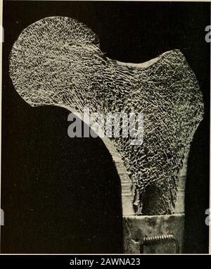 Le problème de l'âge, de la croissance et de la mort; une étude de cytomorphose, basée sur des conférences à l'Institut Lowell, mars 1907 . que d'une coquille externe. En partie sur cette condition dépend de la plus grande responsabilité des os dans l'oldperson à casser. Si nous examinons les muscles que nous semons qu'ils sont devenus moins en volume, Et quand weapper le microscope à eux nous voyons que les singlefies sur lesquelles la force de la dépendance des muscles deviennent de plus en plus petite taille et de moins en nombre.^Professeur B. Morpurgo ^ par une ingénieuse expérience a démontré que l'exercice augmente la taille des muscles en augmentant t Banque D'Images