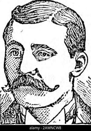 Colonist quotidien (1894-09-28) . y nuits quitte le Power houseer à 23 heures À demi-paBt quatre yoBterday aftormidi département de thofiro waa a appelé à l'extinction firo qui avait commencé dans le tho construction en bois qui est UBed os une annexe à l'hôtel de tho Tole-graphe. Somo ono avait apparemment Lofta allumé cigare sur la table de raquette B et aBlight bluzi était tho résultat, tho chimicalencino mettant hors tho firo beforo il a obtenu ahoadway. Les dégâts ne représentent pas un montant de demain de 10 $ Après la Grip I waa dans un état terrible, faible et misérable. Le docteur a dit que je hadBrlghts maladie.Mes reins étaient inadful condition.Je lis abou Banque D'Images