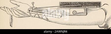 Archives de médecine : une revue bimensuelle consacrée aux communications originales sur la médecine, la chirurgie et leurs branches spéciales. . ter de la quantité de pression nécessaire pour dé- LE SPH YGMOGRAPH EN MÉDECINE. 18 5 velop la trace de pouls a été négligée, et les observateurs n'ont pas cessé de s'éveiller pour les traces de pouls qui devraient être considérées comme pathog-nomonic, ou le diagnostic de certaines conditions pathologiques. Nowque l'importance des éléments de la trace d'impulsion est déterminée, et que l'importance de mesurer la quantité de pression employée pour développer la trace d'impulsion est appréciée, et qu'elle est r Banque D'Images