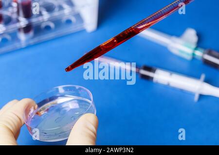 Échantillon de sang avec pipette et boîte de Petri autres tubes de test de sang dans un hôpital d'analyse d'examen en portoir Banque D'Images