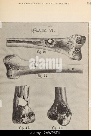 Actes de la réunion annuelle de l'Association des chirurgiens militaires des États-Unis. . fils, ainsi que pour la gamme de plus en plus grande, le fusil de petit calibre est plus destructeur que les vieux armswith plomb balles. Je n'ai pas encore été en mesure d'obtenir le rapport complet en version imprimée publié par le professeur Demosthene, mais je vais incarner un examen de l'itin le document que j'espère préparer à mon retour. Je terminerai par une courte comparaison des résultats obtenus par Kocher à des distances réduites et avec des frais généralement réduits, et ceux de la Commission allemande. Les Allemands ont utilisé des charges complètes à la réalité Banque D'Images