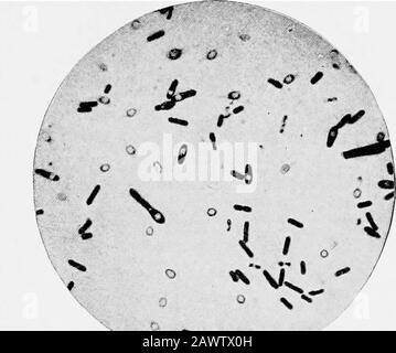 Les essentiels de la bactériologie; être une introduction concise et systématique à l'étude des bactéries et des micro-örganismes alliés . psulatus (de la photographie de ProfessorSiraon Flexner). Mais ils ont probablement eu affaire au Bacillus aerogenescassulatus. Bacillus Enteritidis Sporogenes (Klein, 1895).—Re-gardée comme identique à B. aerogenes capsulatus {q. c.). Bacillus Chauvei.—synonymes.—Bacillus of SymptomaticAnthrax (BoUinger et Feser); Rauschbrand (allemand); Char-bon symptomatique (Arloing, Cornevin et Thomas). Origine.—Ce bacille, décrit en 1879, a été isolé, et par inoculat animal Banque D'Images