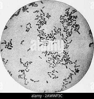 Les fondamentaux de la bactériologie; être une introduction concise et systématique à l'étude des bactéries et des microörganismes alliés . ivitis, et dans les throatsdes individus normaux non exposés. Pseudodiphtérie.—le pseudobacillus de Hoffman est lésé par certains chercheurs pour être mais un diphtheriabacUus affaibli qui a perdu sa puissance toxique, mais sa vraie relation n'est pas établie. Il est morphologiquement identique et parfois retrouvé côte à côte avec le vrai bacille. Il pousse de la gélose au wellon, ne montre pas de granules avec la tache de Neisser, et, contre B. dipMhericB, ne produit pas autant d'acide dans le dextrosebro Banque D'Images