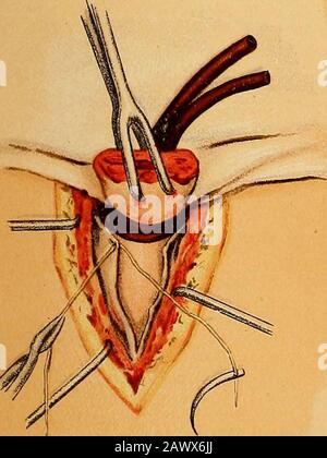 Traité sur gynæcology : médical et chirurgical . Banque D'Images