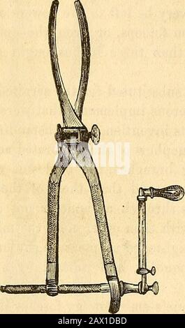 Un traité théorique et pratique sur la midwifery : y compris les maladies de la grossesse et de la parturation et les attentions requises par l'enfant de la naissance à la période de sevrage . articulars de ceux construits jusqu'ici, et qui semble éviter les divers inconvénients que je viens de énumérer. 868 DYSTOCIA Nous avons déclaré ci-dessus que l'absence de courbure dans les bords interférait verysérieusement avec la saisie de la tête, qui est trouvée plus antéro que les pelves mal formées, à la fois en raison de la contraction pelvienne et de sa ownélévation ; nous avons donc donné une courbure à notre for Banque D'Images