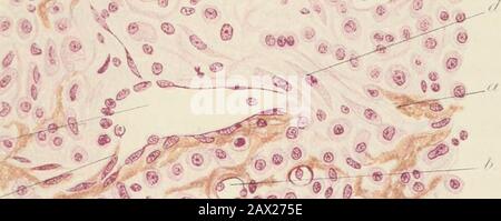 Pathologie pratique; un manuel pour les étudiants et les praticiens . /..^^^^- «&gt; Banque D'Images