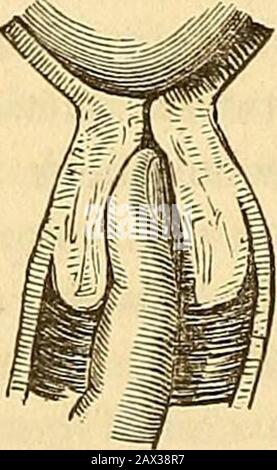 Un traité théorique et pratique sur la midwifery : y compris les maladies de la grossesse et de la parturation et les attentions requises par l'enfant de la naissance à la période de sevrage . Banque D'Images