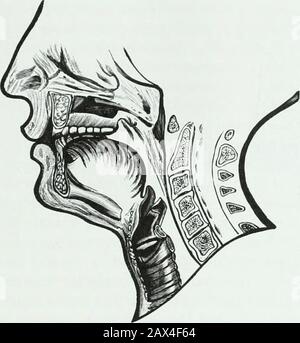 Un traité pratique sur les techniques et les principes de l'orthopée dentaire et de la correction prothétique du palais de fente . s au tubébesien d'Eustachian devrait être vu. Ils ne doivent jamais être couverts ou empiérés par les limites du voile. En dessous de ces ouvertures, les murs sont fréquemment jetés dans des perpendiculaires, qui si elles sont proéminentes, comme elles le sont occasionnellement, et la zone désirée duringcontraction des muscles n'est pas lisse, il peut être nécessaire de légèrement augmenter ou abaisser l'angle du voile à ce point à une zone plus lisse, ou à plus de closelyf5.t aux irrégularités pour assurer le probabil Banque D'Images