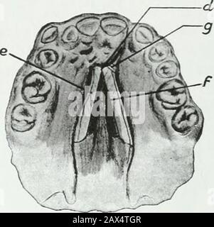 Un traité pratique sur les techniques et les principes de l'orthopée dentaire et de la correction prothétique du palais de fente . Fig. 18. Banque D'Images