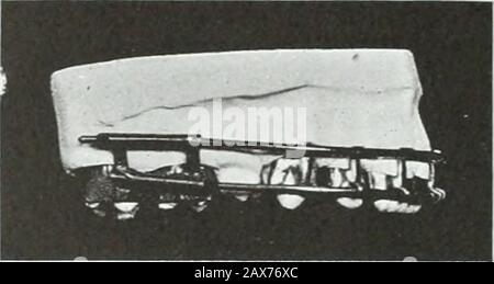 Un traité pratique sur les techniques et les principes de l'orthopée dentaire et de la correction prothétique du palais de fente . 1&gt ; Banque D'Images