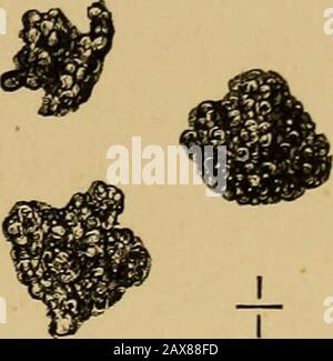 Les calculs biliaires et les maladies des canaux biliaires . Fig. 11.—un groupe de bilirubine-calculs bilirubine-calcium. Quantités considérables, biliverdin-calcium et bili-fuscin : la cholestériine est présente en quantité minute. (6) formes De Rareurs.— (a) gravier de cholestéroléine amorphe et incomplètement cristallin. — Elles varient en sizèle d'un grain de sable à celui d'un grand pois, et souvent Banque D'Images