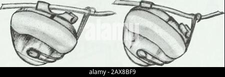 Un traité pratique sur les techniques et les principes de l'orthopée dentaire et de la correction prothétique du palais de fente . B Banque D'Images