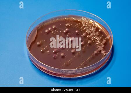 Colonies bactériennes sur une plaque de boîte de Petri de milieu de gélose avec de la gélose MacConkey Banque D'Images