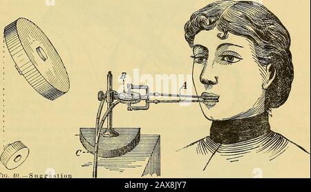 Homme et homme anormal, y compris une étude des enfants, en rapport avec des factures pour établir des laboratoires sous les gouvernements fédéral et d'État pour l'étude des classes criminelles, pauper et défectueuses, avec des bibliographies . Fig. 39.—miroir-hypiotizer. L'un est plus grand que les autres, nous pensons que la plus grande oue est la plus lourde avant de les souliver. Mais si en les soulevant, la plus grande ne ressent pas la contre-suggestion plus lourde et aninconsciente semble rendre ug sentir le plus petit bloc plus lourd; il. Fig. 40,—Suggestionblocks. (Gilbert.) Fig. 41.—Labiographe. (Rouaselot.) est une illustration du Banque D'Images