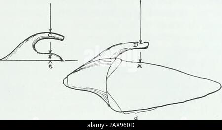 Un traité pratique sur les techniques et les principes de l'orthopée dentaire et de la correction prothétique du palais de fente . Dans la combinaison pour le déplacement corporel des dents, à travers les possibilités ofestabhshing un fulcrum indépendant à la zone occlusale ou incisale, le seul objet Fig. .-.fl. Banque D'Images